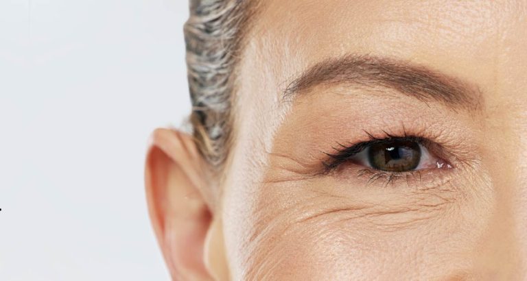 Wrinkles@72x-50